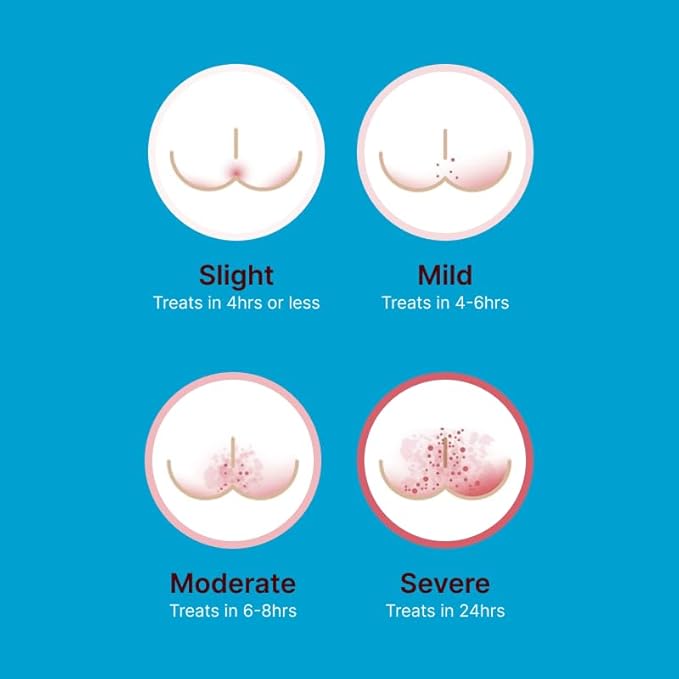 Diaper Rash Cream | 100% Natural Zinc Oxide Maximum Strength Butt Paste | Barrier Baby Cream to Help, Relieve, & Prevent Diaper Rash | Hypoallergenic Remedy for Newborns, Infants | 4oz