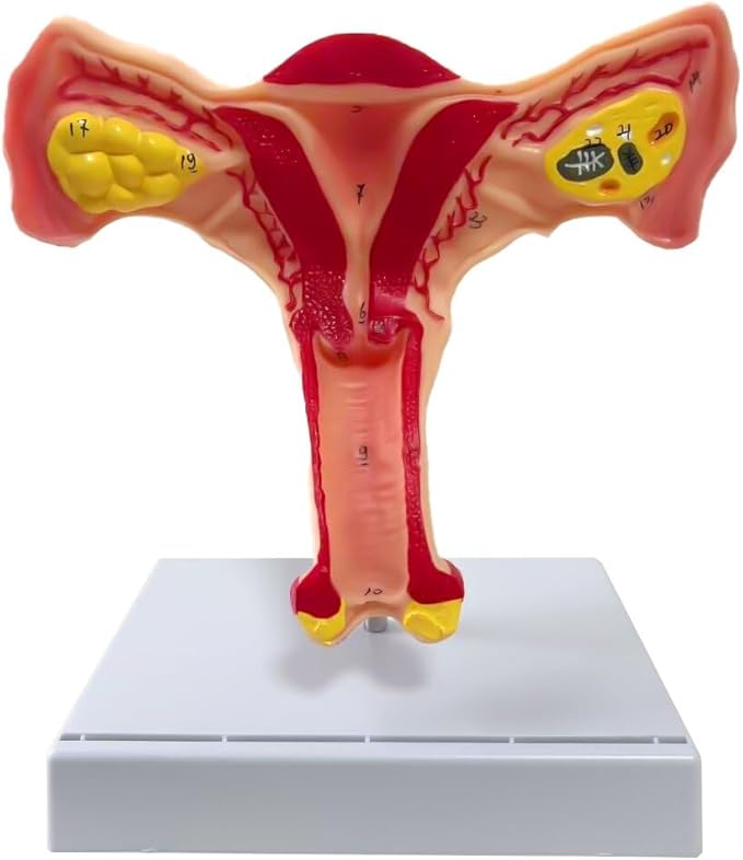 Female Uterus and Ovary Anatomical Model，Human Female Genital Organ for Medical Science Education Study or Teaching