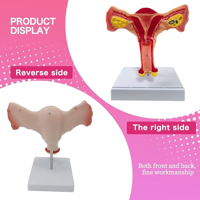 Female Uterus and Ovary Anatomical Model，Human Female Genital Organ for Medical Science Education Study or Teaching