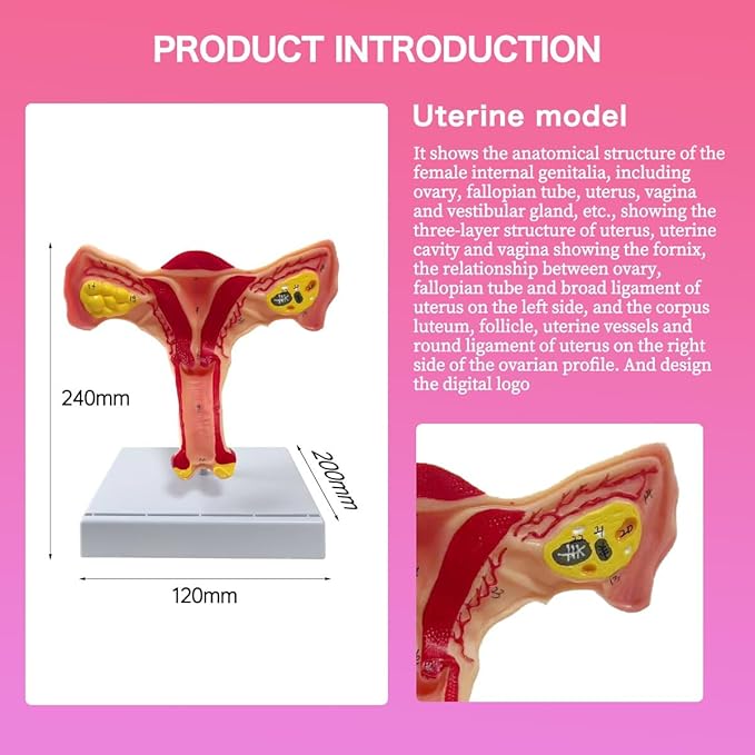 Female Uterus and Ovary Anatomical Model，Human Female Genital Organ for Medical Science Education Study or Teaching